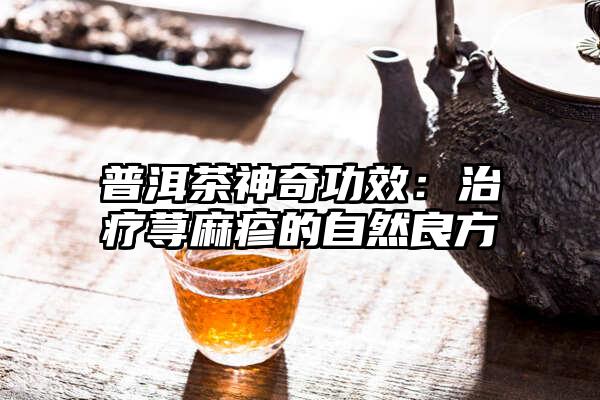 普洱茶神奇功效：治疗荨麻疹的自然良方